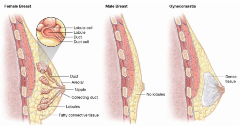 Boston gynecomastia specialists male breast cross section vs. female breast