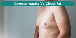 Boston gynecomastia specialists gynecomastia vs. chest fat