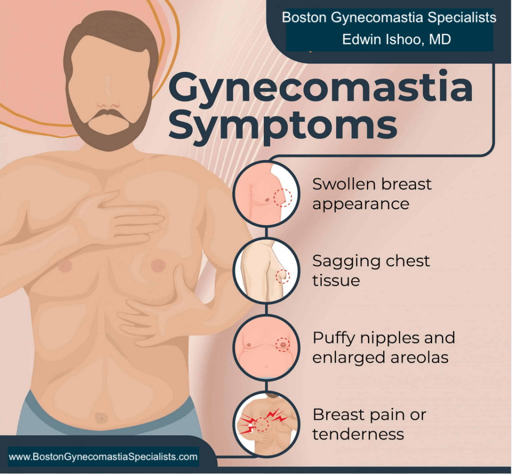 Gynecomastia symptoms