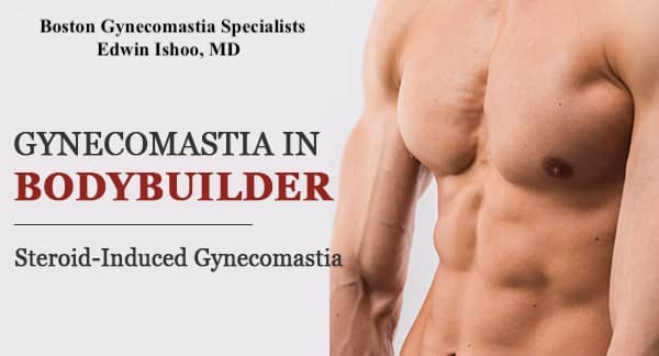 Gynecomastia in bodybuilders