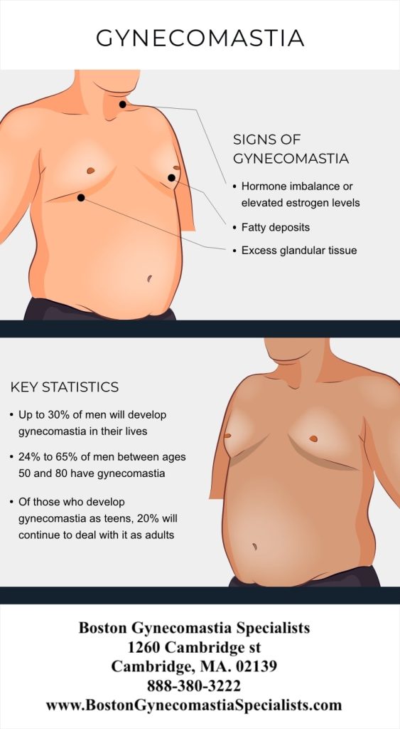 Senior Gynecomastia