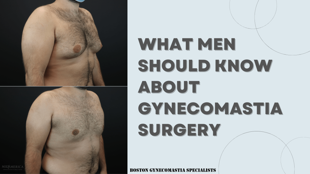 what to know about Gynecomastia surgery