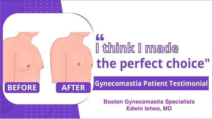 Patient reviews at Boston Gynecomastia Specialists