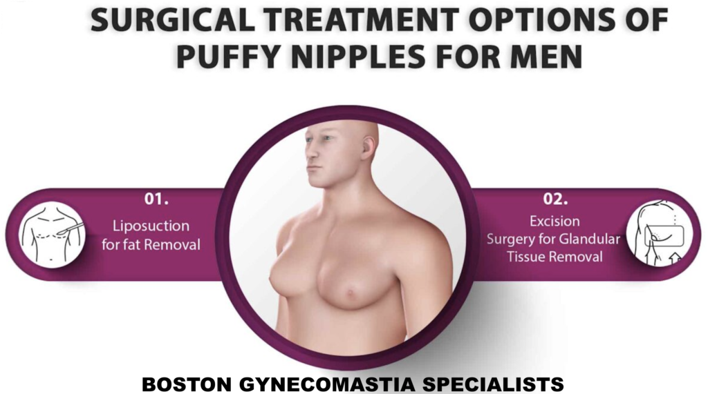 Boston gynecomastia specialists PUFFY NIPPLE SURGERY OPTIONS