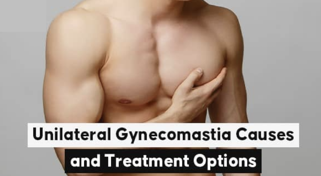 Boston gynecomastia specialists unilateral