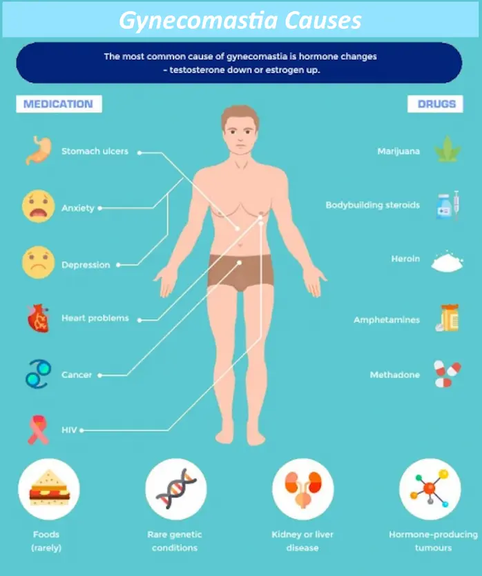 Gynecomastia causes