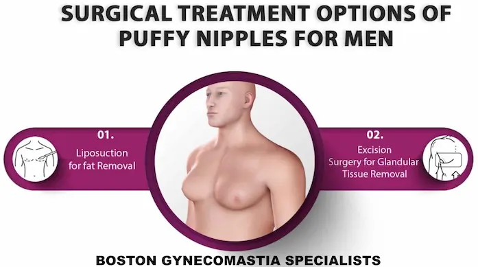 PUFFY NIPPLE SURGERY OPTIONS