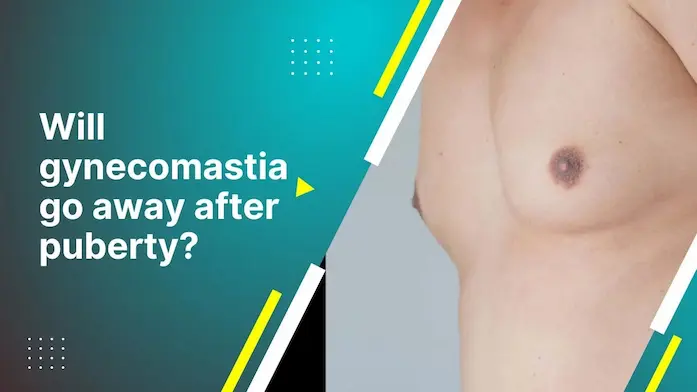 Puberty Gynecomastia