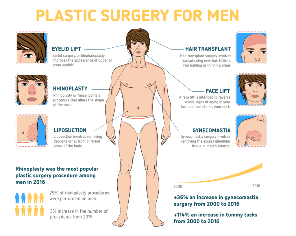 Popular plastic surgery procedure for men