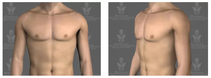 frontal and oblique views of ideal male chest